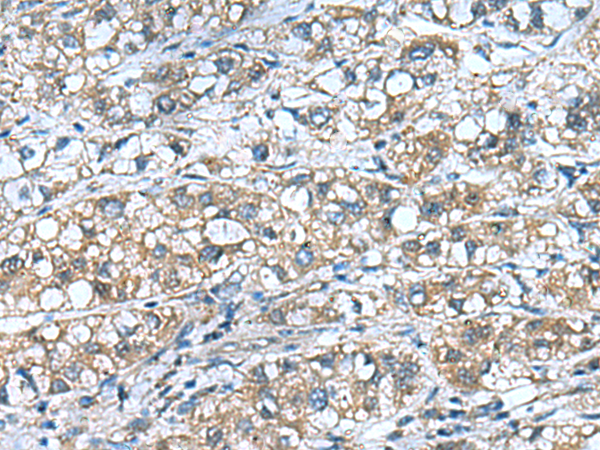 COMMD9 antibody