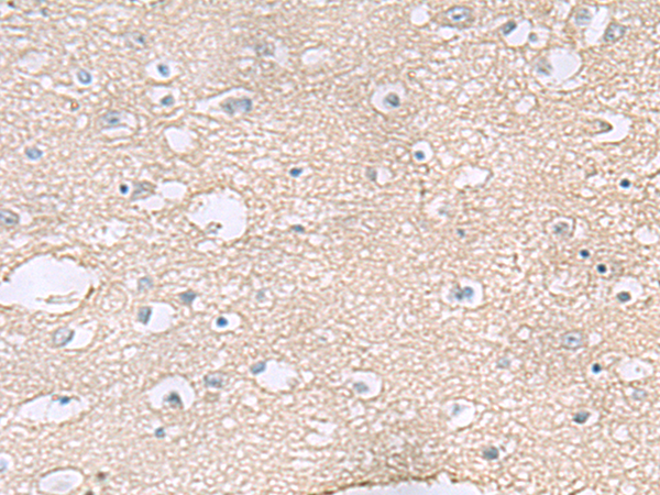 TAGLN3 antibody
