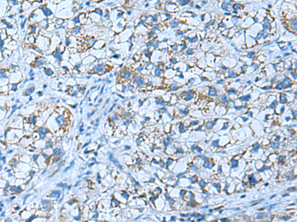 GUCA1A antibody