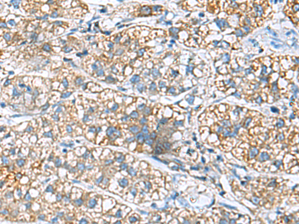 JOSD1 antibody