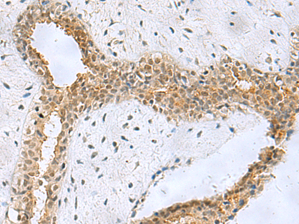 NABP1 antibody
