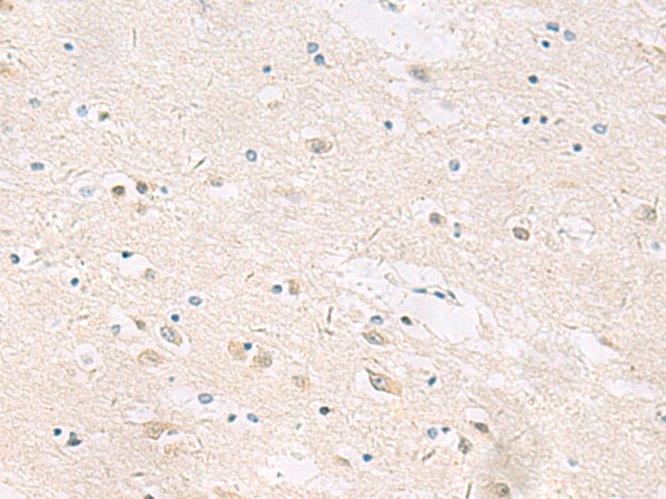 ANKS6 antibody