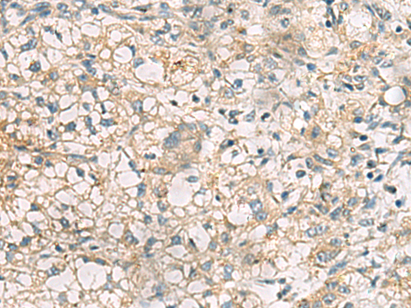 RTP4 antibody