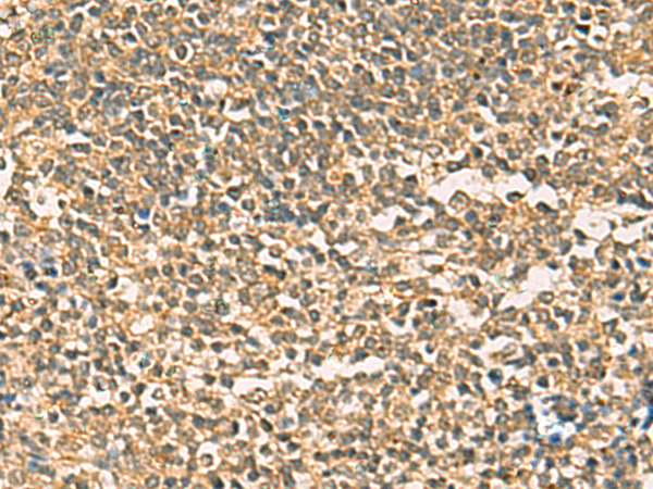 THG1L antibody