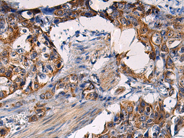 RITA1 antibody