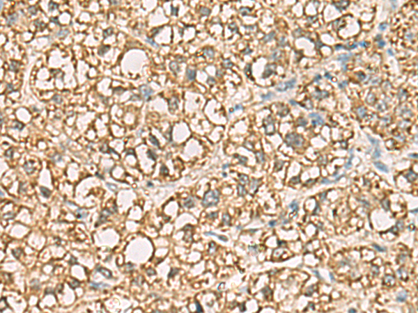 VTA1 antibody