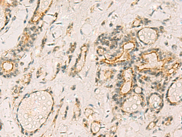 HORMAD2 antibody