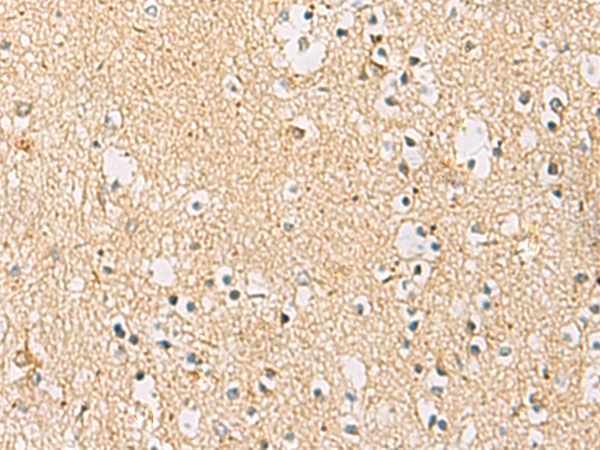 IDS antibody
