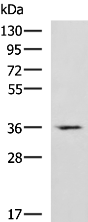 CRYM antibody