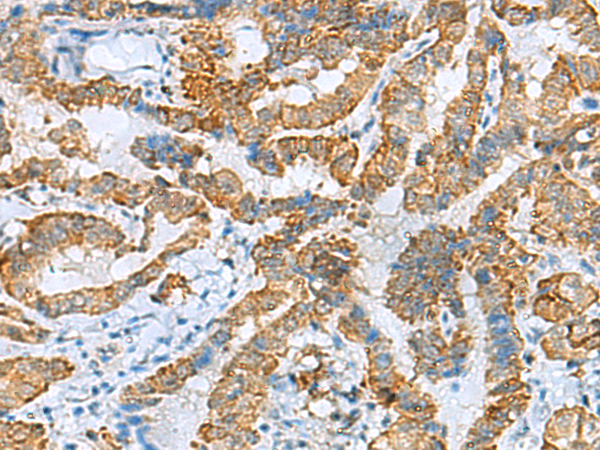 FBXO8 antibody