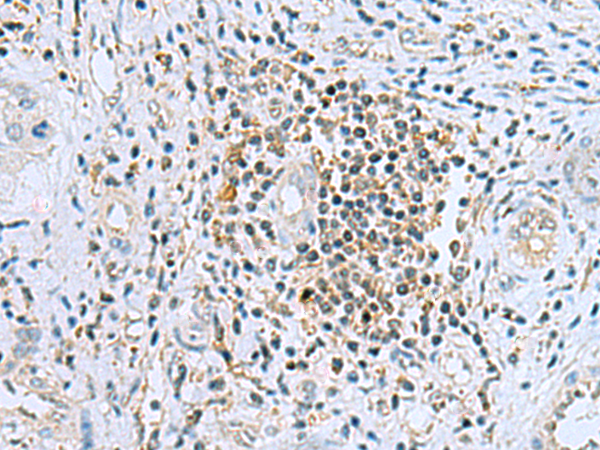 DHRS7B antibody