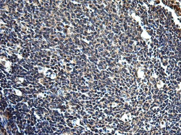 PRRT2 antibody