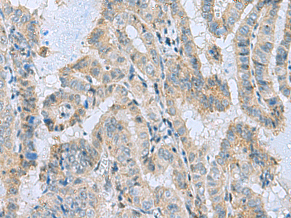 MGME1 antibody
