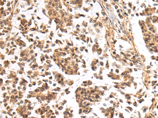 NHLRC2 antibody