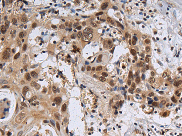ZNF821 antibody