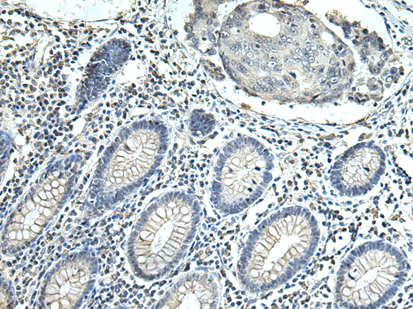 SLC35F6 antibody
