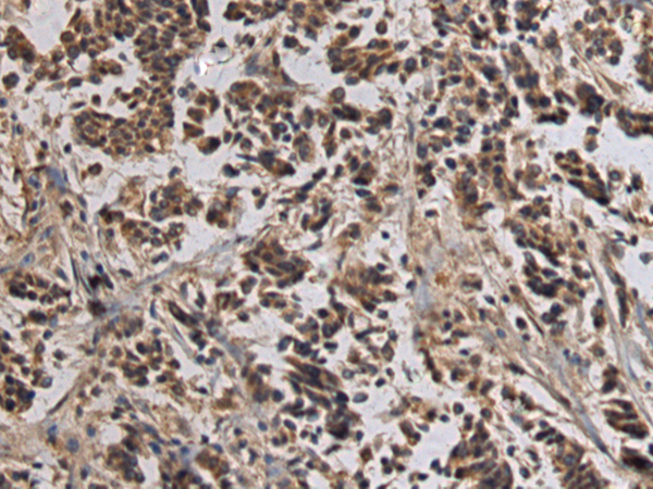 TLL1 antibody