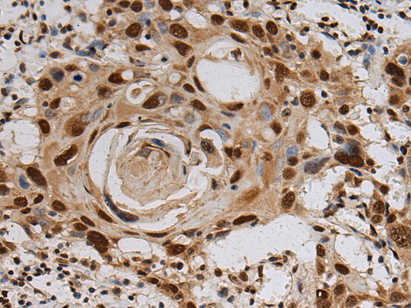 KIN antibody