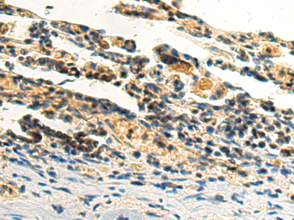 BCS1L antibody