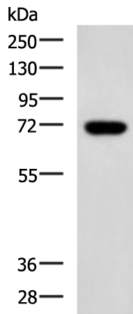 ENTPD4 antibody