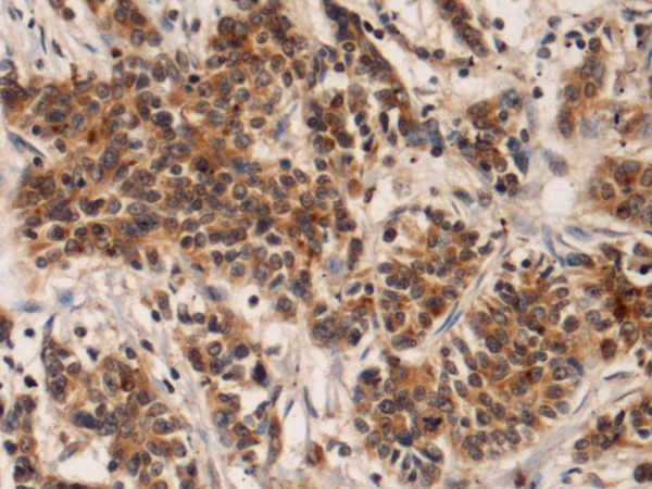IQSEC1 antibody