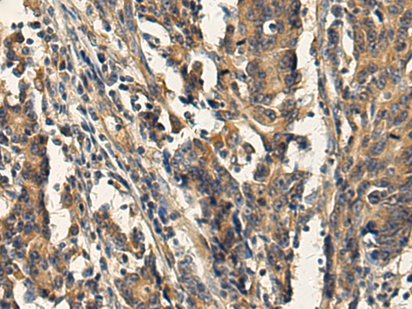AP3B1 antibody