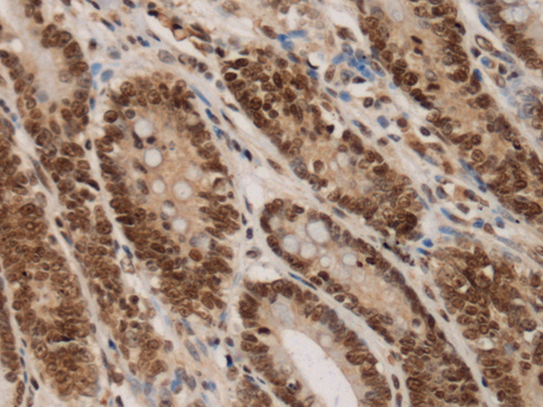 DHX38 antibody
