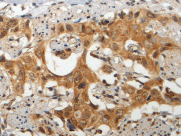 GEMIN6 antibody