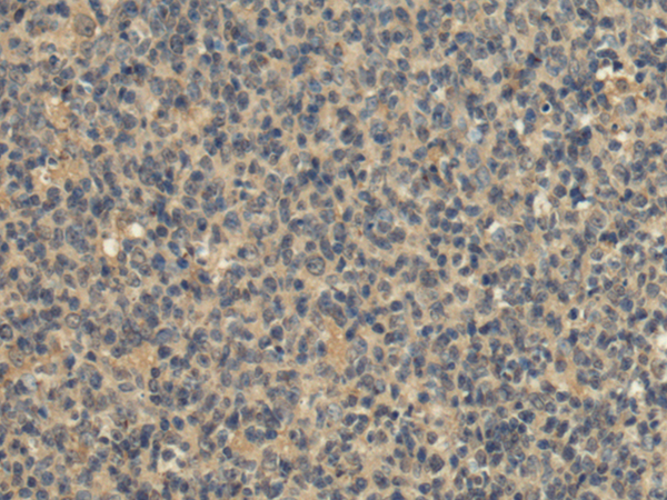KATNA1 antibody