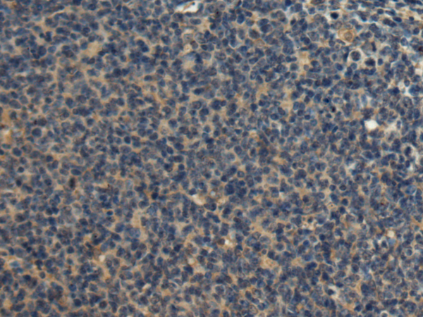 FRG1 antibody