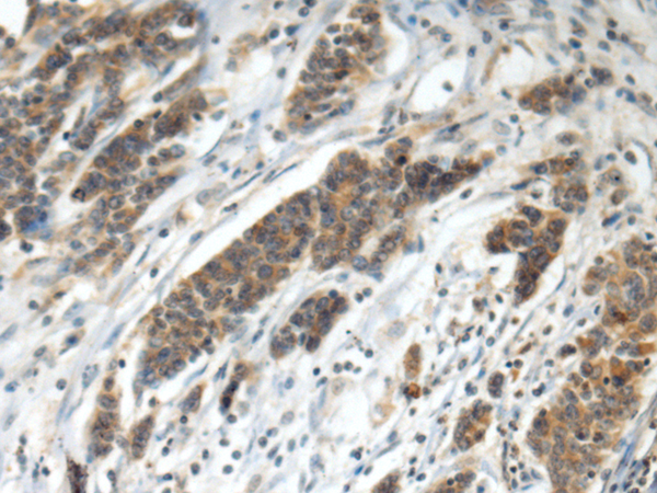 HEPH antibody