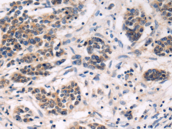 DIP2A antibody