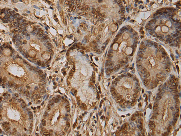 LBH antibody