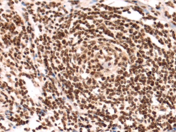 FBXL21P antibody