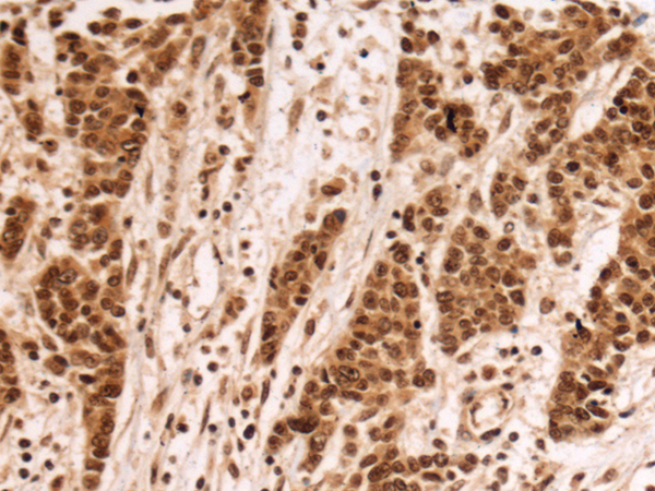 FBXL17 antibody