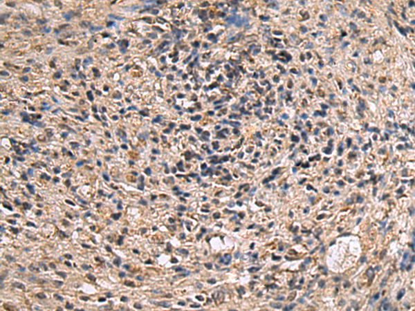 ITIH2 antibody