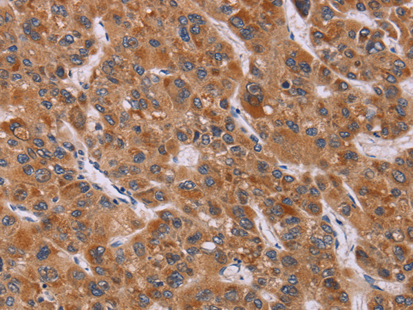 CALCA/CALCB antibody