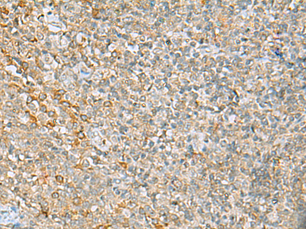 LRRC49 antibody