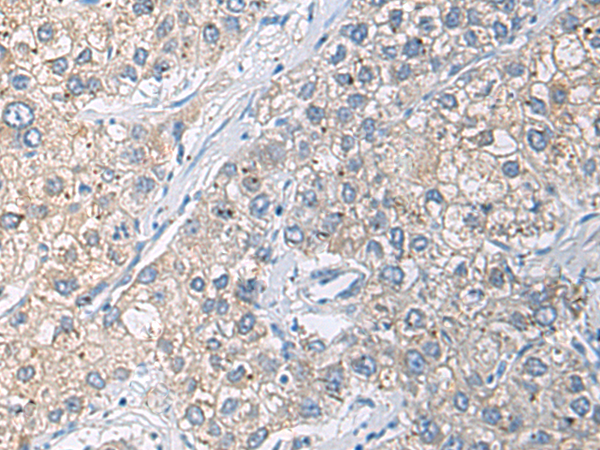 CHRND antibody