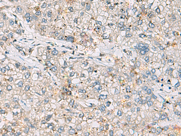 ARIH1 antibody
