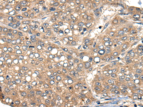 ACER1 antibody