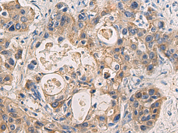 DMRTA2 antibody