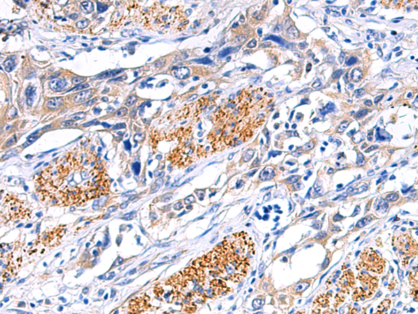 DPP6 antibody