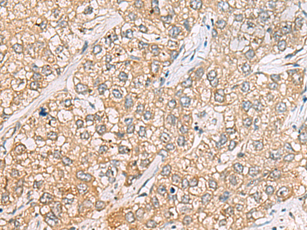 P3H2 antibody