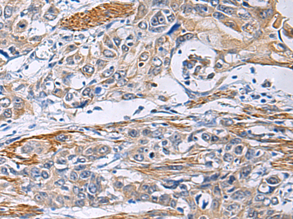 FBXO45 antibody