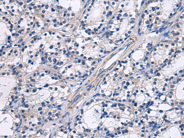 GRAMD2A antibody