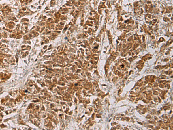 HOXC5 antibody