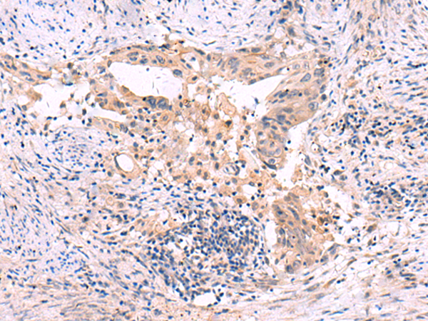 SLC12A5 antibody
