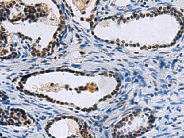 CCAR2 antibody