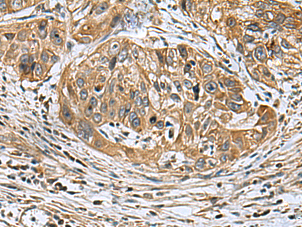 EARS2 antibody